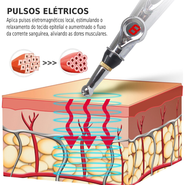 Caneta de Acupuntura Eletrônica e Massagem Corporal EasyPen